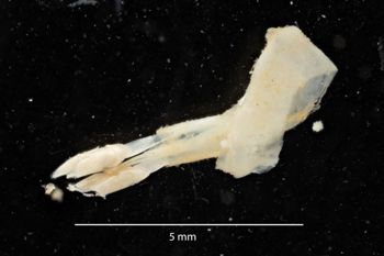 Media type: image;   Malacology 169905 Description: Digital documentation photo of preserved specimen.;
